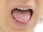5.舌の検査